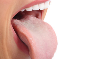 Серый язык в стоматологии. Что означает?