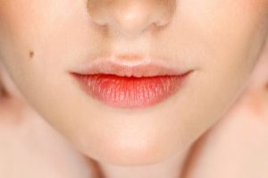 Воспаление слизистой губ или хейлит