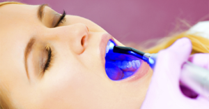 Почему лазерное отбеливание зубов безопасно?
