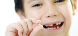 Удаление молочных зубов под наркозом