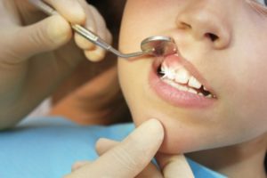 Что делать, если молочные зубы остались у взрослого?