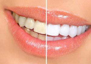 Что нужно знать о чистке зубов?