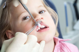 Нужно ли удалять молочные зубы ребенку?