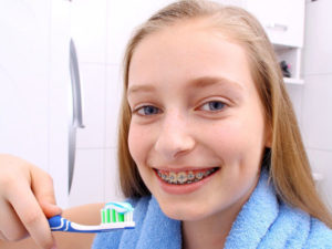 Как правильно чистить зубы при наличии брекетов?