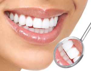 Наращивание зубов в стоматологии