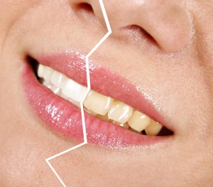 Вред постоянного курения для зубов