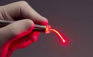 Лазер для протезирование зубов