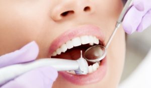 Лечение зубов без страха и боли