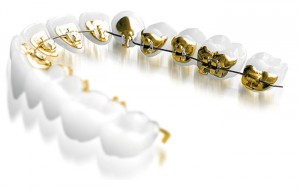 Инкогнито и лечение зубов под секретом