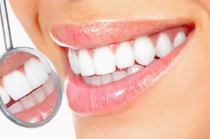 Как проводить домашнее отбеливание зубов?