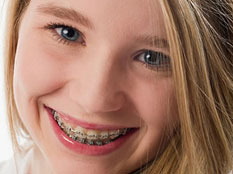 Удаление зубов и ортодонтия