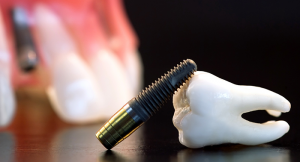 Показания и противопоказания экспресс-имплантации зубов
