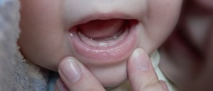 Какие признаки прорезывания зубов?