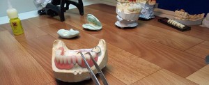 Сколы на зубных коронках и починка