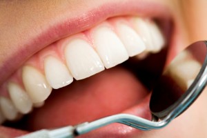 Плюсы и минусы наращивания зубов