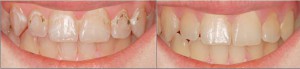 Лечение зубов, протезирование зубов в Сумах