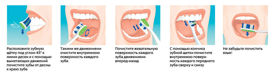 Как почистить зубной протез от налета в домашних условиях Как почистить зубной протез от налета в домашних условиях