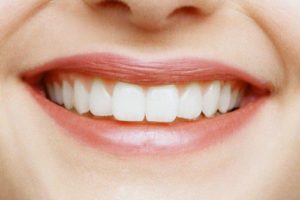 Все этапы эстетической реставрации зубов