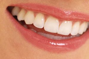 Какие зубы лучше вставить? Протезирование