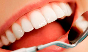 IPS e.max - эстетическая керамика на зубы