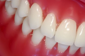 Список болезней десен в стоматологии