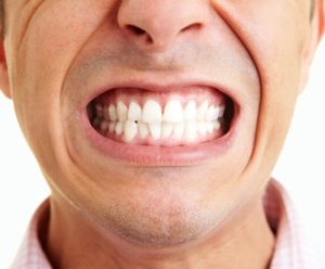 Есть ли противопоказания для имплантации зубов?