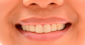 Причины желтых зубов