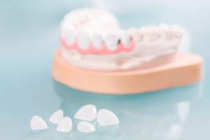 Другие виды протезирования зубов