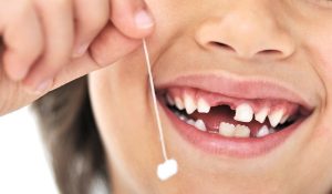Что делать родителям в период смены зубов?